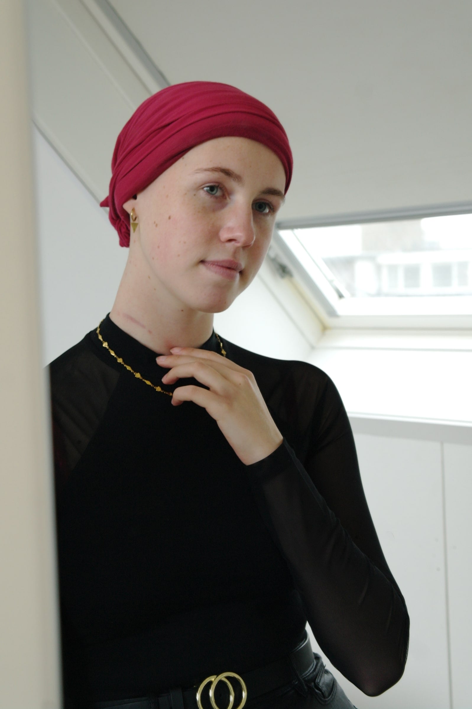 Jonge vrouw met een bordeauxrode hoofddoek staat in daglicht bij een dakraam en legt haar hand tegen haar hals, waar een litteken zichtbaar is